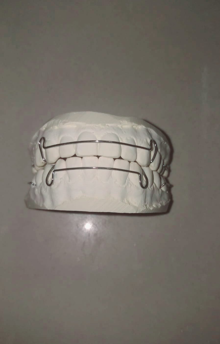 Retenedor de Alambre